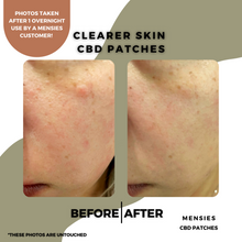 Load image into Gallery viewer, Clearer Skin CBD Patches